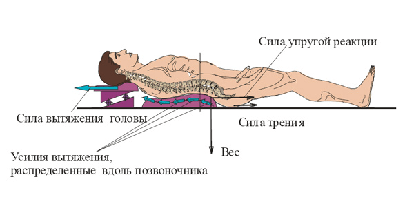 Компьютерное вытяжение позвоночника что это