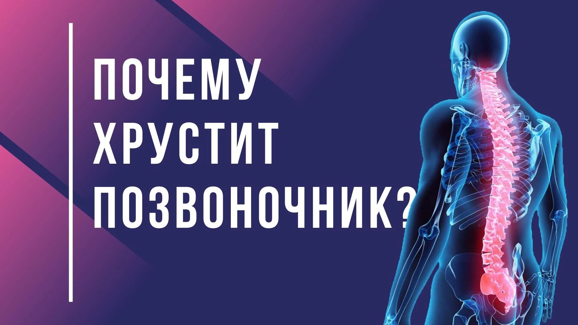 Почему хрустит позвоночник