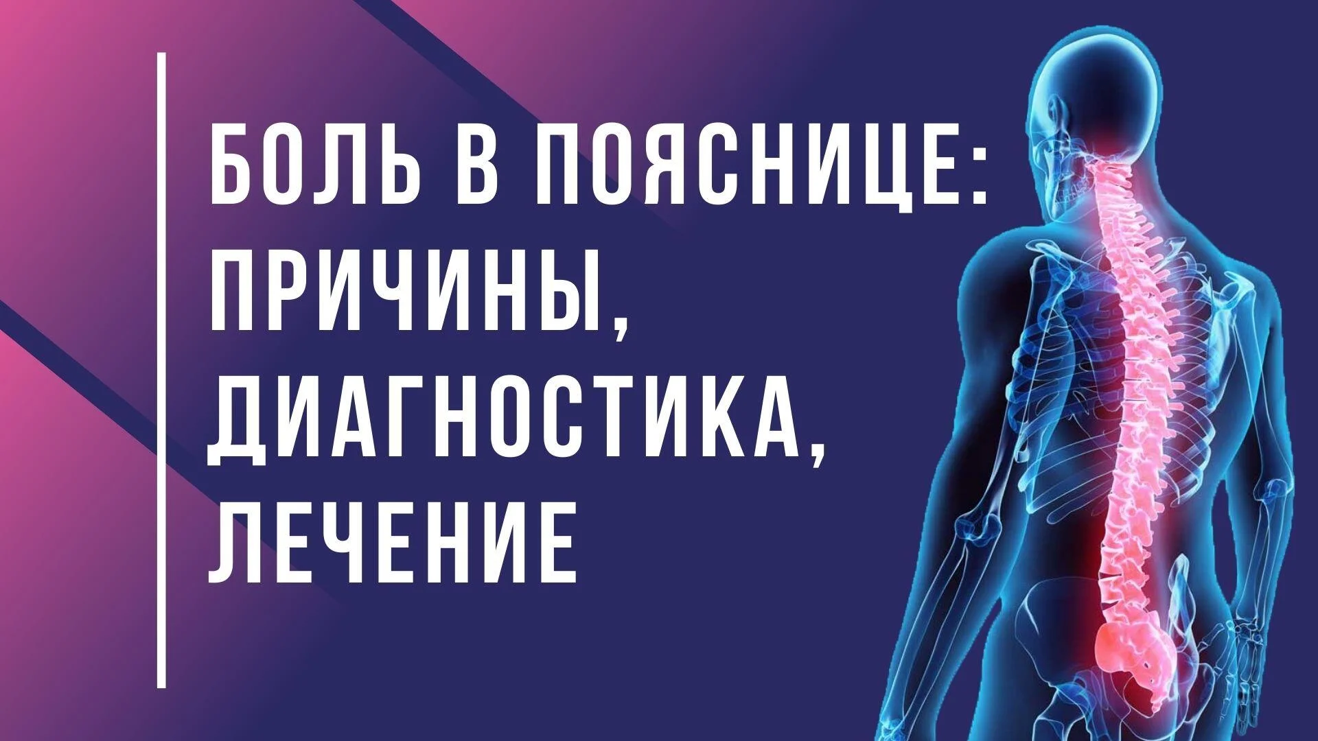 Боль в пояснице причины, диагностика, лечение