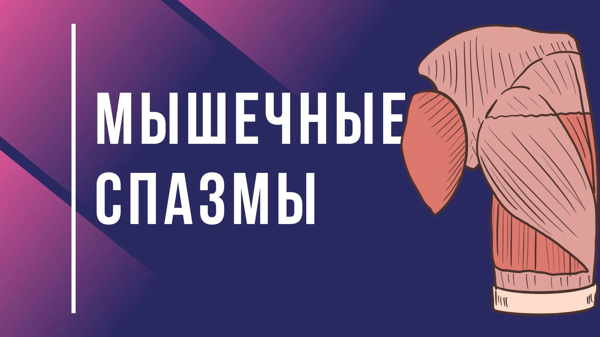 мышечные спазмы